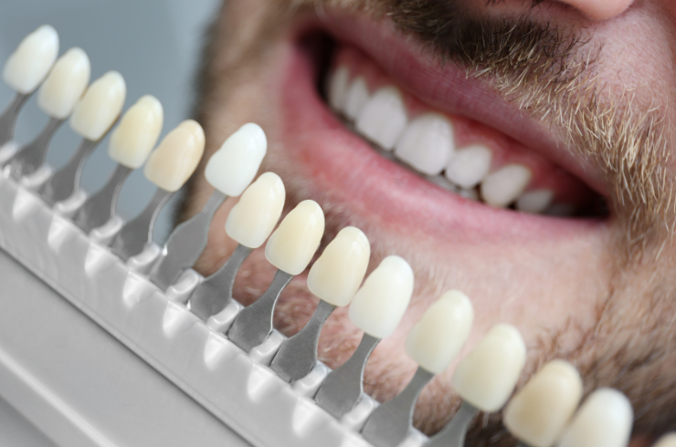 Oral Dental Care