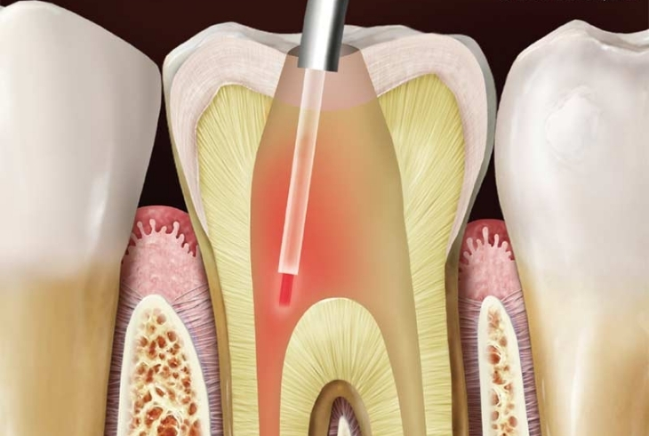 Oral Dental Care