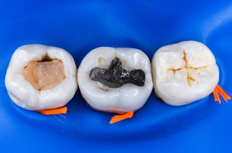 Oral Dental Care
